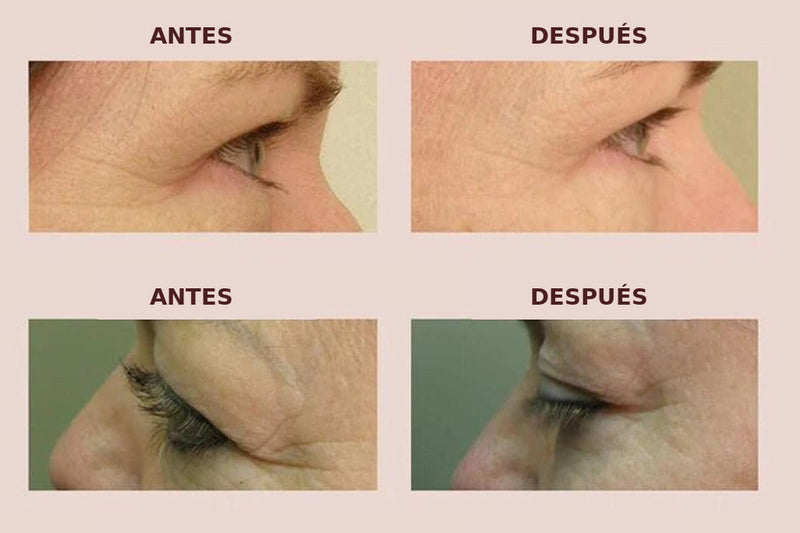 Antes y después